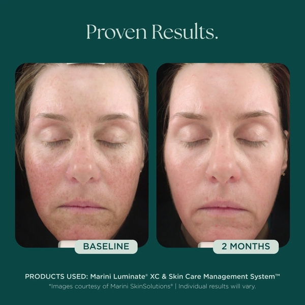 MARINI SKINSOLUTIONS Marini Luminate® Face Lotion – Tinh Chất Dưỡng Sáng Da Và Hỗ Trợ Làm Mờ Tăng Sắc Tố