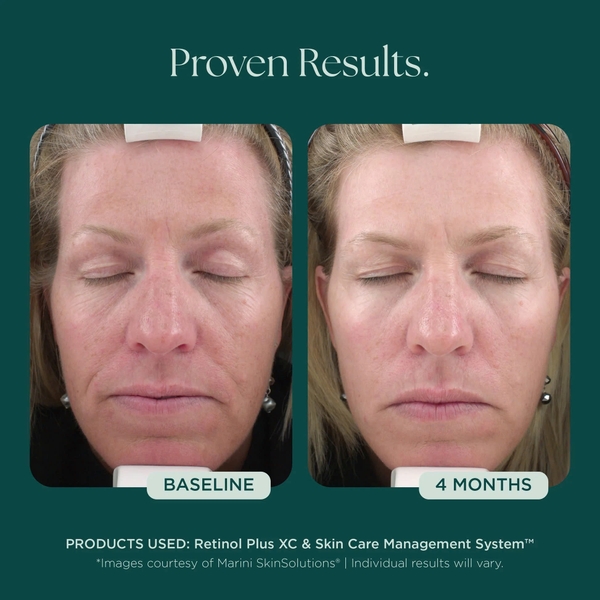 MARINI SKINSOLUTIONS Retinol Plus XC Face Cream – Kem Dưỡng Hỗ Trợ Chống Lão Hóa & Tái Tạo Bề Mặt Da