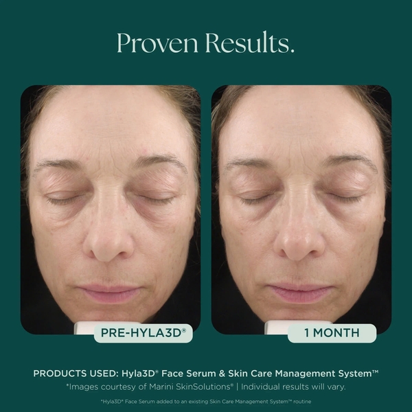 MARINI SKINSOLUTIONS Hyla3D® Face Serum – Tinh Chất Hyaluronic Acid Đa Tầng Hỗ Trợ Cấp Ẩm Và Giúp Da Trông Căng Đầy