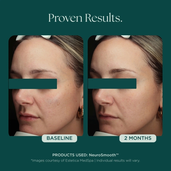 MARINI SKINSOLUTIONS NeuroSmooth® Face Serum – Tinh Chất Peptides Hỗ Trợ Mịn Bề Mặt Da Và Phục Hồi Sau Liệu Trình