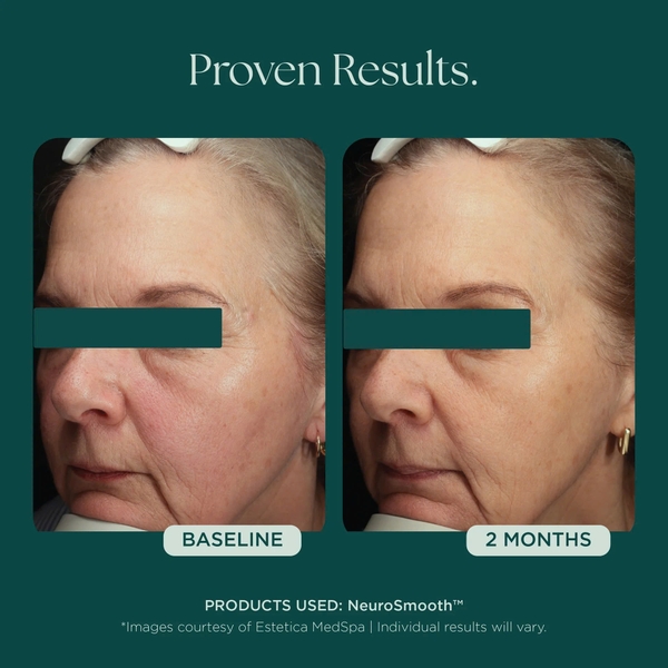 MARINI SKINSOLUTIONS NeuroSmooth® Face Serum – Tinh Chất Peptides Hỗ Trợ Mịn Bề Mặt Da Và Phục Hồi Sau Liệu Trình