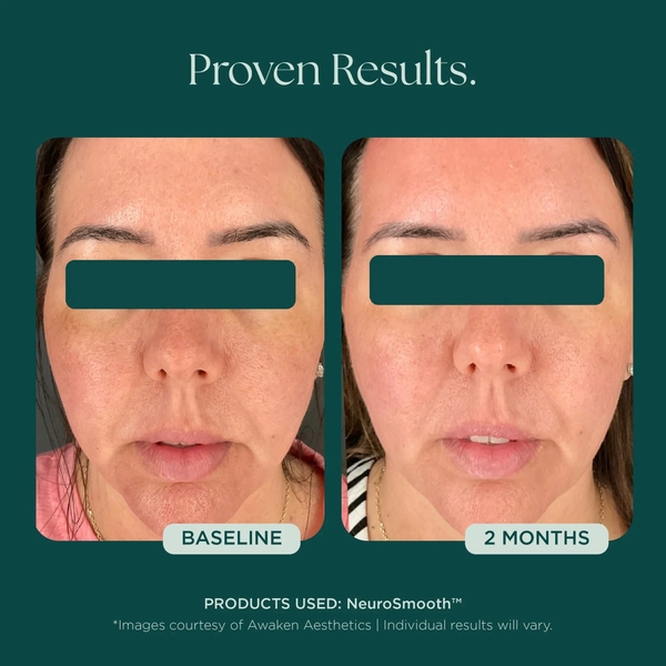 MARINI SKINSOLUTIONS NeuroSmooth® Face Serum – Tinh Chất Peptides Hỗ Trợ Mịn Bề Mặt Da Và Phục Hồi Sau Liệu Trình