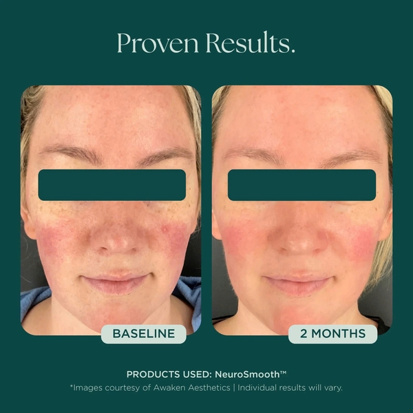 MARINI SKINSOLUTIONS NeuroSmooth® Face Serum – Tinh Chất Peptides Hỗ Trợ Mịn Bề Mặt Da Và Phục Hồi Sau Liệu Trình