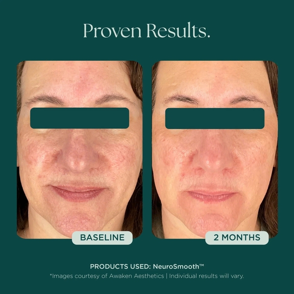 MARINI SKINSOLUTIONS NeuroSmooth® Face Serum – Tinh Chất Peptides Hỗ Trợ Mịn Bề Mặt Da Và Phục Hồi Sau Liệu Trình