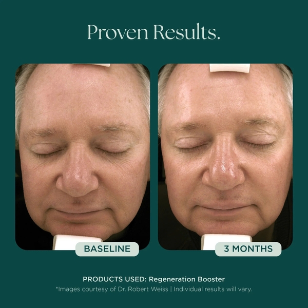 MARINI SKINSOLUTIONS Regeneration Booster Face Lotion – Tinh Chất Dưỡng Hỗ Trợ Tái Tạo Da Và Giảm Dấu Hiệu Lão Hóa