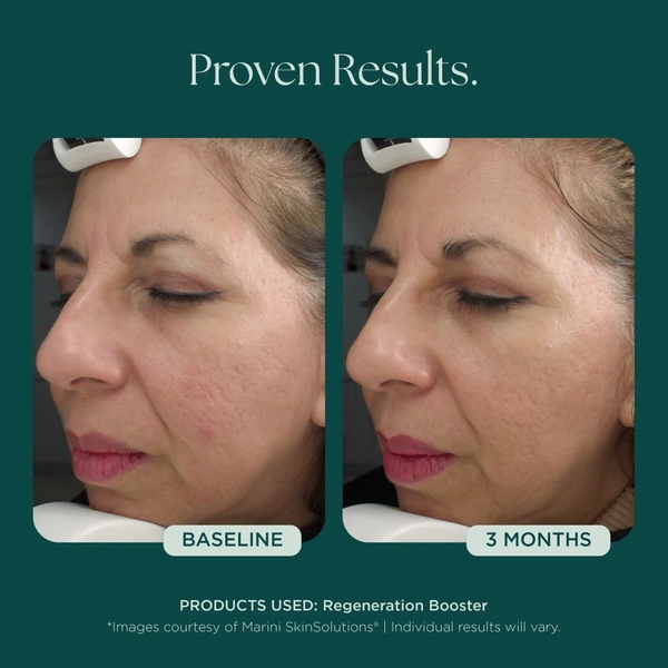 MARINI SKINSOLUTIONS Regeneration Booster Face Lotion – Tinh Chất Dưỡng Hỗ Trợ Tái Tạo Da Và Giảm Dấu Hiệu Lão Hóa