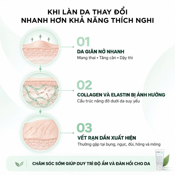 StretcHeal Anti Stretch Marks & Scars Cream 180ml – Kem hỗ trợ cải thiện rạn da và sẹo