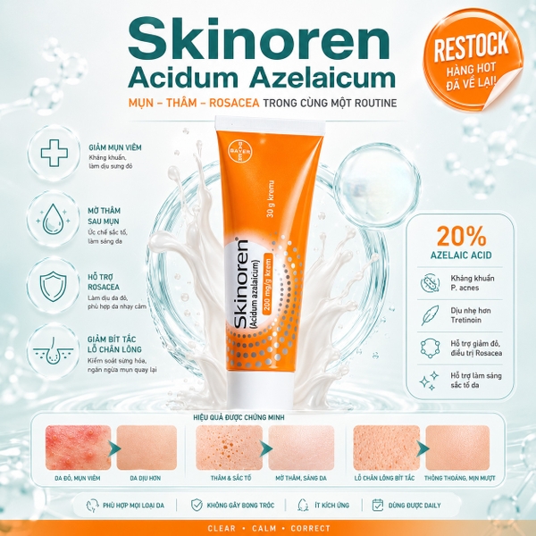 Skinoren Acidum Azelaicum: Kem Trị Mụn, Mờ Thâm & Điều Trị Rosacea Chuyên Sâu