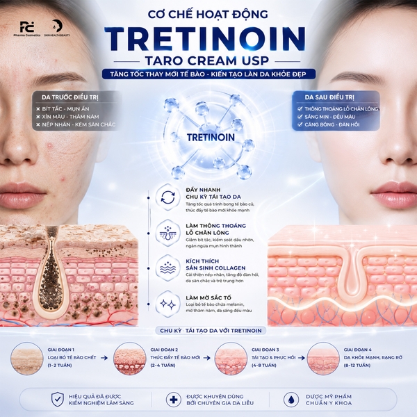 TRETINOIN TARO CREAM USP: Liệu Pháp Đặc Trị Mụn, Nếp Nhăn & Sắc Tố Với Hiệu Quả Đã Được FDA Công Nhận