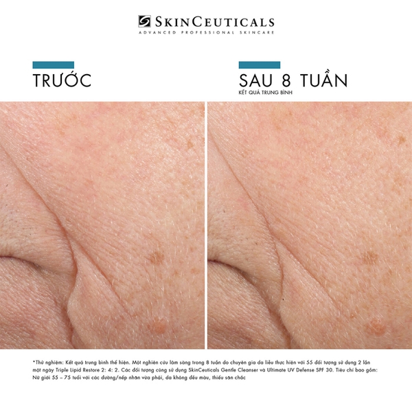SKINCEUTICALS TRIPLE LIPID RESTORE 2:4:2 / KEM DƯỠNG DA GIÚP DƯỠNG ẨM, LÀM DA MỀM MẠI, GIẢM NẾP NHĂN