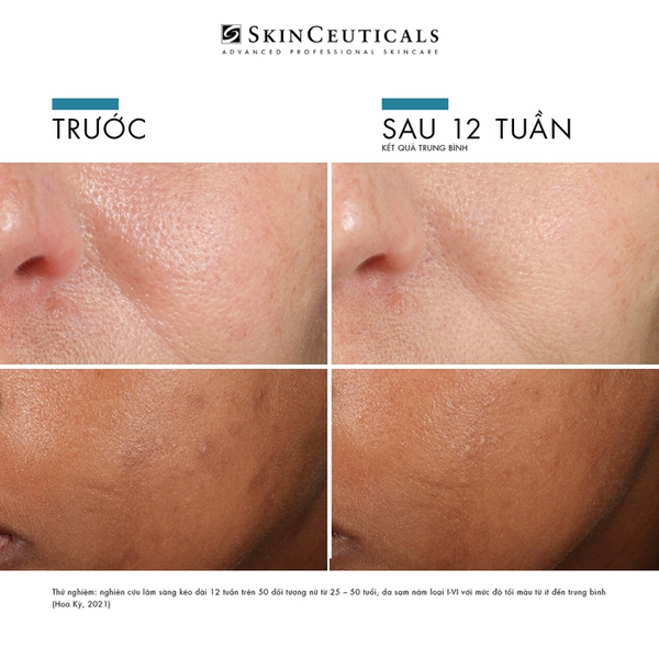 SKINCEUTICALS PHLORETIN CF: Tinh Chất Chống Oxy Hóa Mạnh Mẽ, Sáng Da & Cải Thiện Đốm Nâu