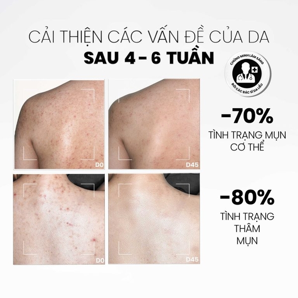 MDCARE E.X.F.O EXFOLIATING BODY SPRAY / XỊT TẨY TẾ BÀO CHẾT TOÀN THÂN