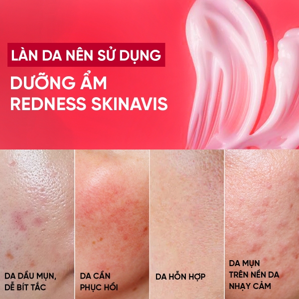 SKINAVIS ADVANCE REDNESS CREAM: Kem Dưỡng Ẩm Chuyên Sâu, Làm Dịu & Giảm Mẩn Đỏ Cho Da Nhạy Cảm