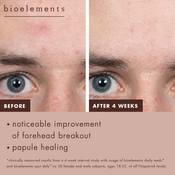 Bioelements Spot Defy – Kem Chấm Mụn Lưu Huỳnh 5% Giúp Giảm Mụn Qua Đêm