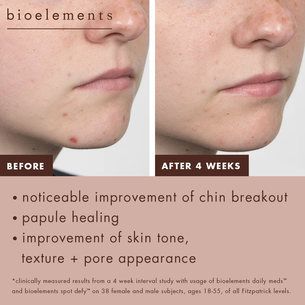 Bioelements Daily Meds – Tinh Chất Trị Mụn 2% Salicylic Acid Làm Thông Thoáng Lỗ Chân Lông