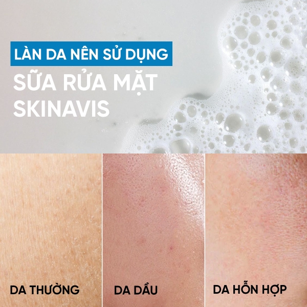 Skinavis Gentle Cleanser: Sữa Rửa Mặt Dịu Nhẹ - Làm Sạch Sâu & Cân Bằng Độ Ẩm Cho Da