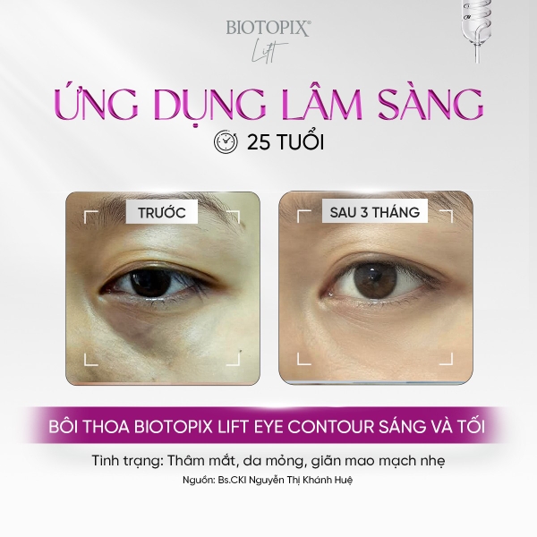 BIOTOPIX® Lift Eye Contour Cream – Kem Nâng Cơ, Trẻ Hóa & Chống Sụp Mí Mắt Chuyên Sâu
