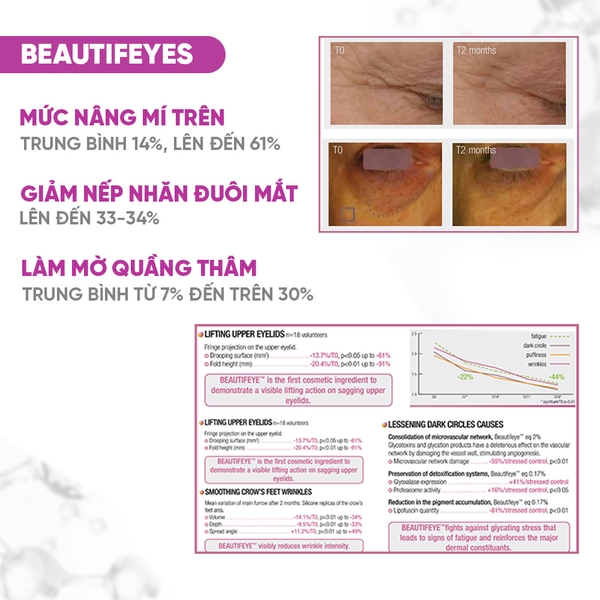 BIOTOPIX® Lift Eye Contour Cream – Kem Nâng Cơ, Trẻ Hóa & Chống Sụp Mí Mắt Chuyên Sâu