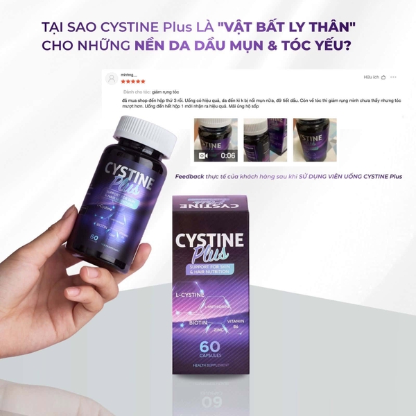 Cystine Plus 60 Viên – Viên uống hỗ trợ giảm mụn, hạn chế rụng tóc và nuôi dưỡng làn da