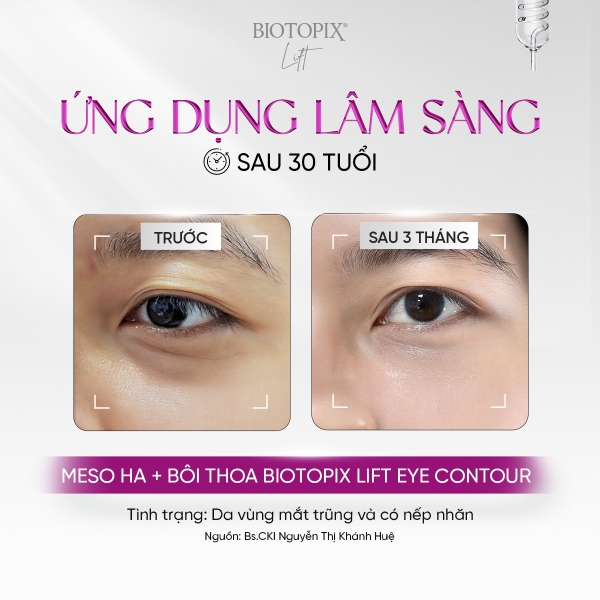 BIOTOPIX® Lift Eye Contour Cream – Kem Nâng Cơ, Trẻ Hóa & Chống Sụp Mí Mắt Chuyên Sâu
