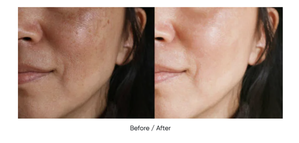 Mineaderm Liposomal Arbutin Serum – Tinh Chất Dưỡng Sáng, Làm Mờ Thâm Sạm Và Đều Màu Da Chuyên Sâu
