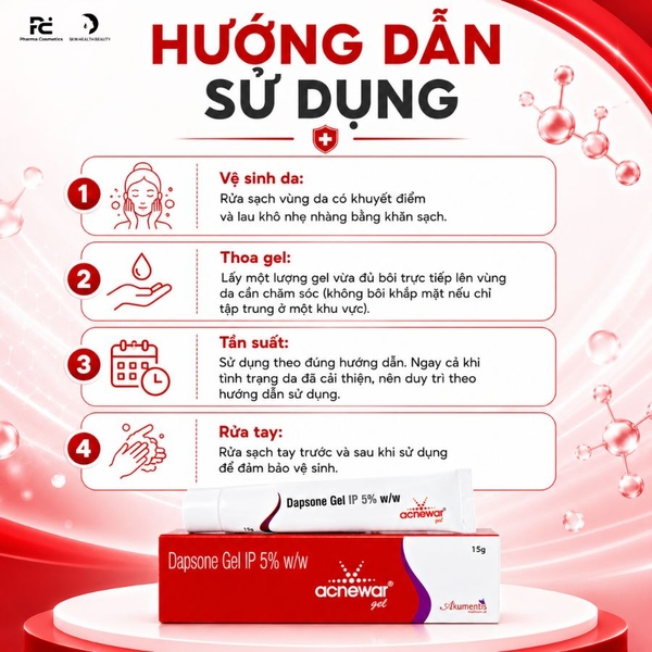 Acnewar Gel 15g: Giải Pháp Kháng Khuẩn, Giảm Sưng Viêm Và Điều Trị Mụn Hiệu Quả