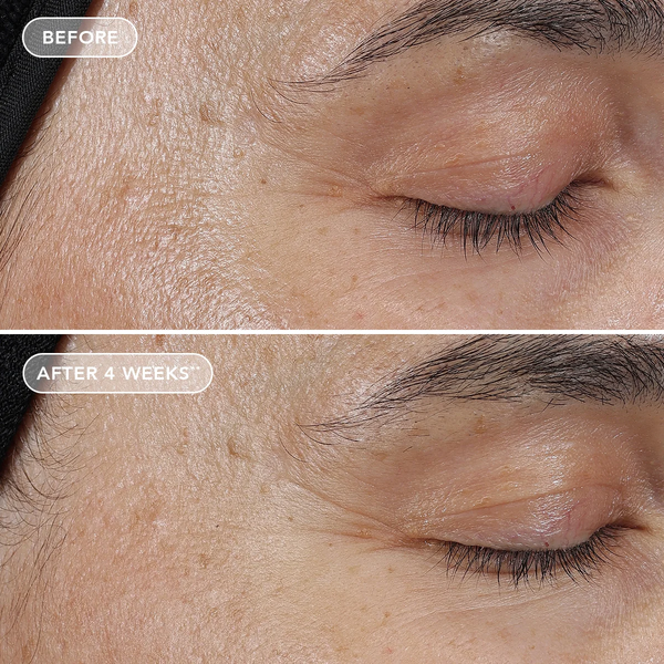 IMAGE Skincare AGELESS+ Retinol Pure Liquid Retinol 0.3% – Serum retinol dành cho da đã thích nghi da hỗn hợp, da dầu
