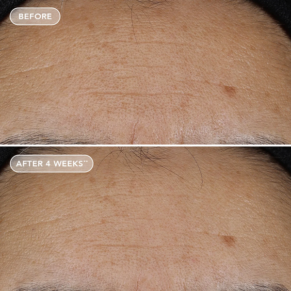 IMAGE Skincare AGELESS+ Retinol Repair Crème 0.3% Retinol Complex – Kem dưỡng retinol làm sáng và chống lão hóa cho người mới bắt đầu, da nhạy cảm, da khô.