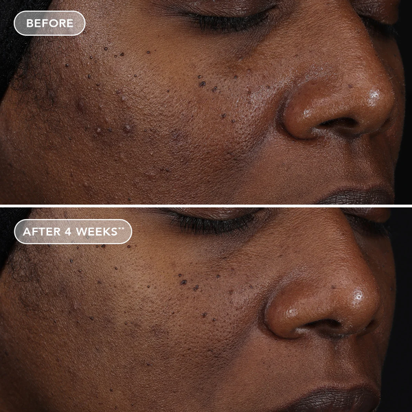 IMAGE Skincare AGELESS+ Retinol Repair Crème 0.3% Retinol Complex – Kem dưỡng retinol làm sáng và chống lão hóa cho người mới bắt đầu, da nhạy cảm, da khô.