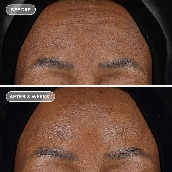 IMAGE Skincare AGELESS+ Retinol Treatment Crème 1.2% Retinol Complex – Kem retinol nồng độ cao chống lão hóa chuyên sâu