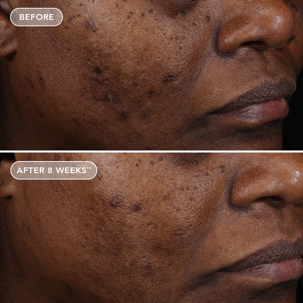 IMAGE Skincare AGELESS+ Retinol Treatment Crème 1.2% Retinol Complex – Kem retinol nồng độ cao chống lão hóa chuyên sâu
