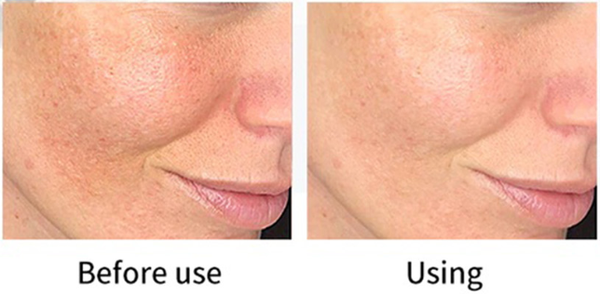 PHARMAFORM C-SMOOTHING SERUM: Tinh Chất Tái Tạo & Sáng Da - Đánh Bay Thâm Nám, Cho Làn Da Mịn Màng