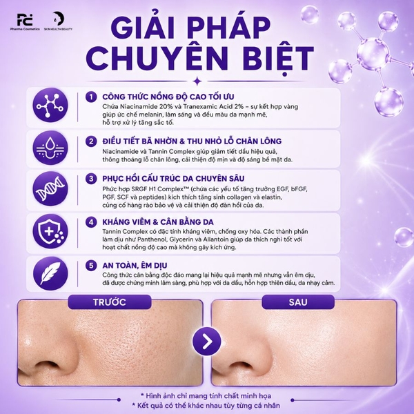AHOHWA PORE NIACIN 20: Tinh Chất Niacinamide 20% - Giải Pháp Toàn Diện Thu Nhỏ Lỗ Chân Lông & Dưỡng Sáng
