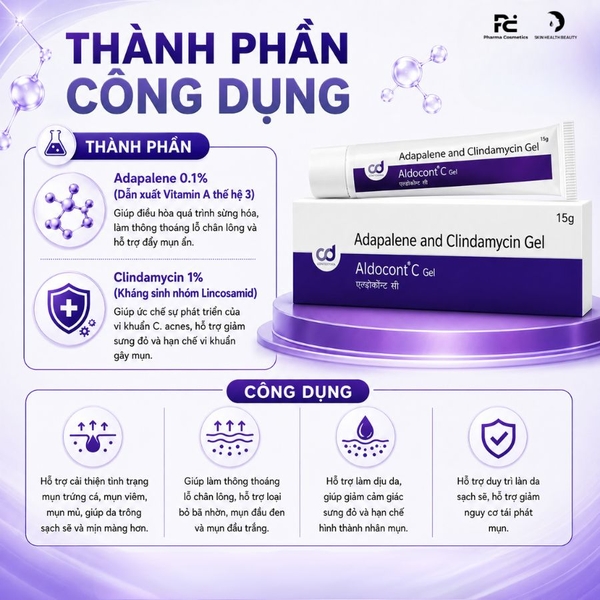 Aldocont C Gel: Giải Pháp Hỗ Trợ Điều Trị Mụn Trứng Cá, Mụn Viêm & Dày Sừng Từ Adapalene & Clindamycin