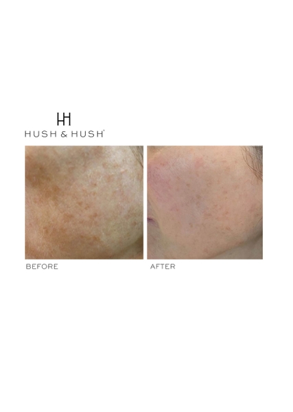 HUSH & HUSH SkinCapsule BRIGHTEN +/ VIÊN UỐNG SÁNG DA VÀ MỜ THÂM NÁM (THUẦN CHAY)