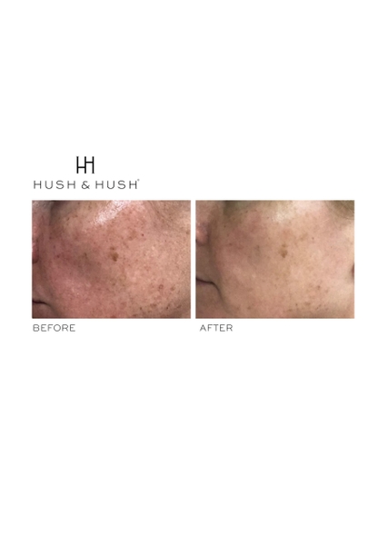 HUSH & HUSH SkinCapsule BRIGHTEN +/ VIÊN UỐNG SÁNG DA VÀ MỜ THÂM NÁM (THUẦN CHAY)