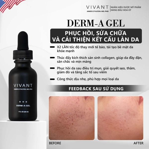 Vivant Derm-A-Gel® – Serum Retinoid Khởi Đầu Giúp Trẻ Hóa Và Làm Sáng Da Vượt Trội