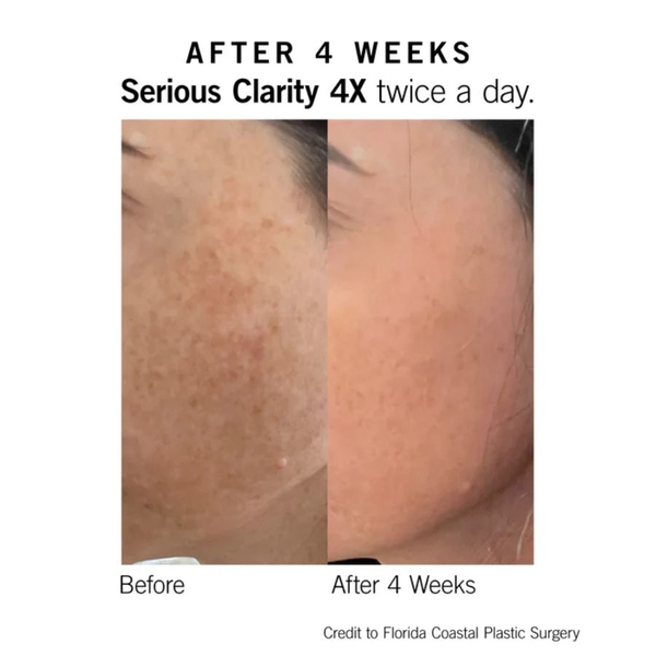 NEOVA SERIOUS CLARITY 4X COMPLEXED BRIGHTENING SERUM / SERUM LÀM TRẮNG DA, CẢI THIỆN NÁM, DA KHÔNG ĐỀU MÀU