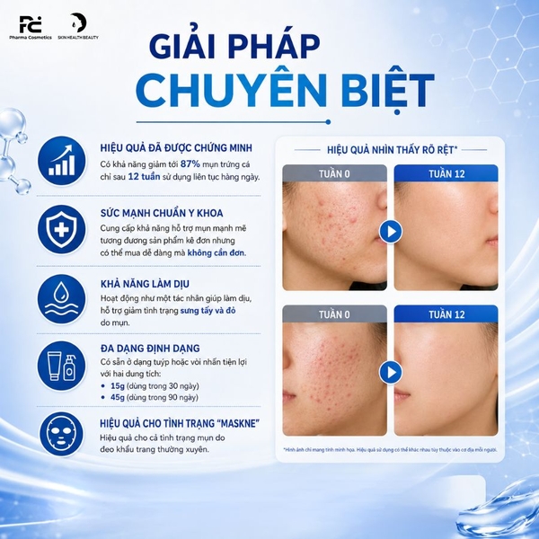 Differin Adapalene Gel 0.1%: Giải Pháp Trị Mụn Retinoid Chuẩn Y Khoa Cho Làn Da Sạch Mụn