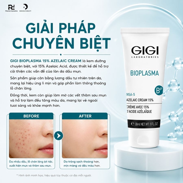 GIGI BIOPLASMA 15% AZELAIC CREAM / KEM BÔI GIÚP GIẢM MỤN, KHÁNG VIÊM, MỜ THÂM 