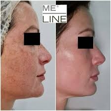 MELINE Caucasian Skin Night 02 – Kem Đêm Hỗ Trợ Làm Mờ Đốm Sắc Tố & Dưỡng Sáng Đều Màu Da