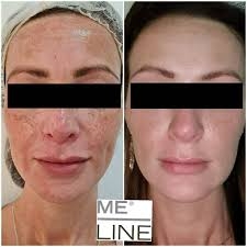 MELINE Caucasian Skin Night 02 – Kem Đêm Hỗ Trợ Làm Mờ Đốm Sắc Tố & Dưỡng Sáng Đều Màu Da