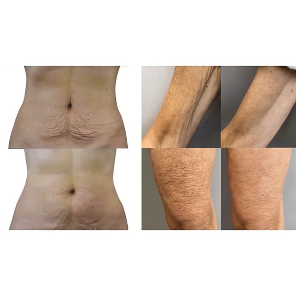 PFOFHILO FIGURA BODY CREAM / KEM DƯỠNG THỂ TÁI TẠO VÀ SĂN CHẮC DA TOÀN DIỆN