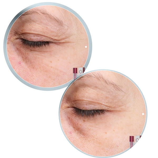 Morphiya Intensive Treatment – Kem Dưỡng Cao Cấp Hỗ Trợ Trẻ Hóa Và Tăng Cường Độ Đàn Hồi Cho Da