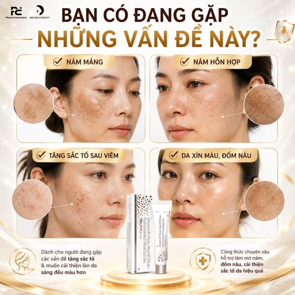 TRILUMA CREAM (ẤN ĐỘ): Giải Pháp Vàng Trị Nám, Tàn Nhang & Lão Hóa Chuyên Sâu