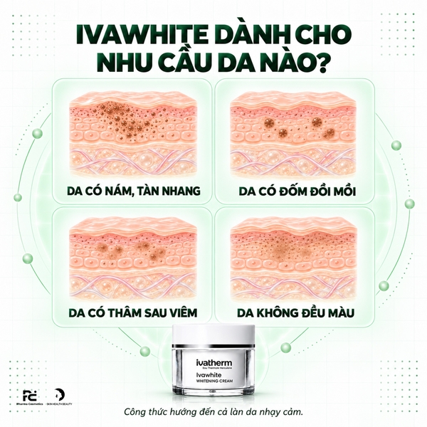 Ivawhite Whitening Cream: Kem Dưỡng Làm Sáng Da, Hỗ Trợ Giảm Nám & Tăng Cường Vẻ Rạng Rỡ