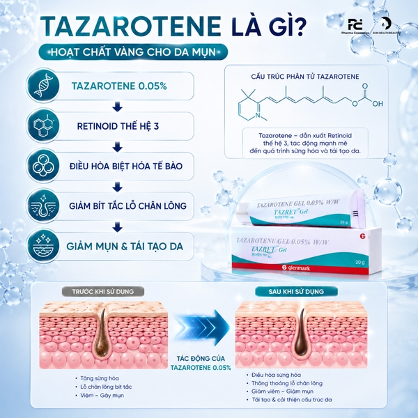 TAZAROTENE GEL 0.05% (TAZRET GEL): Gel Trị Mụn & Phục Hồi Sẹo Thâm - Tái Tạo Làn Da Sáng Khỏe