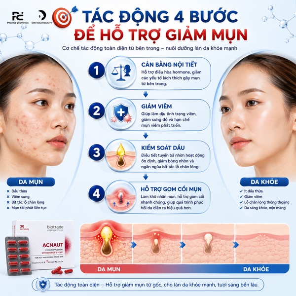Biotrade Acnaut Food Supplement – Viên Uống Trị Mụn Giải Pháp Sạch Mụn Từ Bên Trong