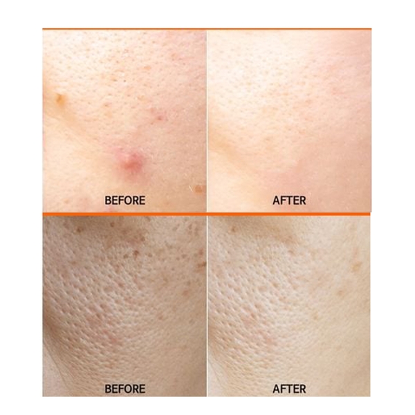 FAU SHINY PUMPKIN: Liệu Pháp Peel Enzyme Bí Đỏ Trẻ Hóa & Tái Tạo Cấu Trúc Da