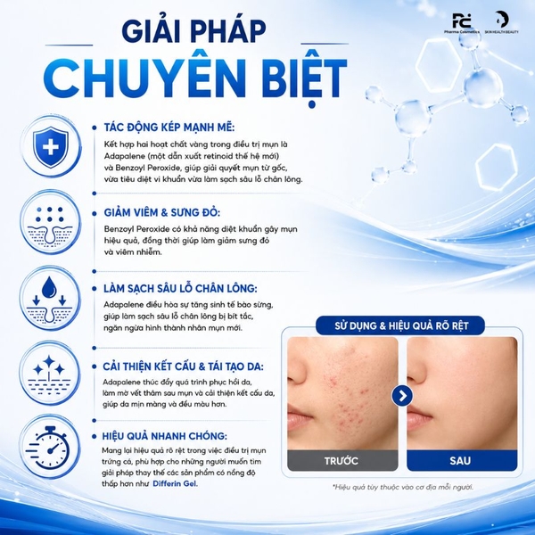 Klena Duo Forte Topical Gel: Gel Đặc Trị Mụn - Sạch Sâu, Giảm Viêm & Ngăn Ngừa Tái Phát